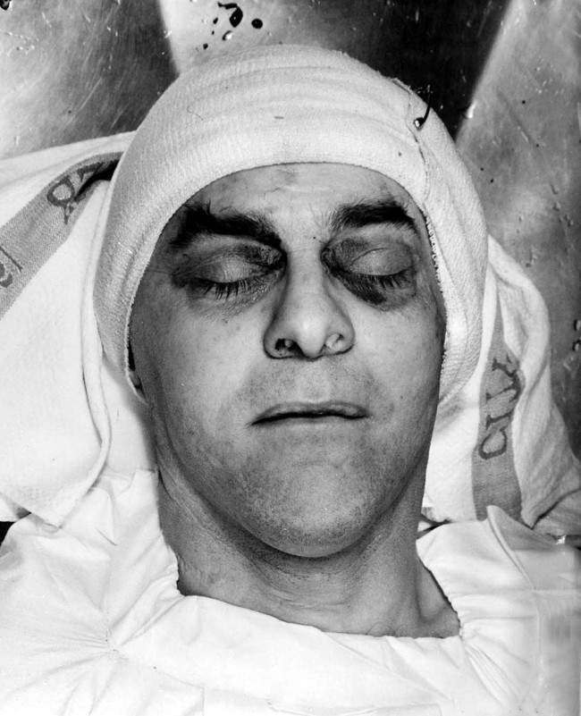 A police photograph of the dead man George Cornell who was killed at the Blind Beggar - A-Dead-George-Cornell-1966-PA-1491291