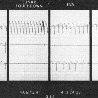 ECG Data Suggests Did Michael Collins Died On Apollo 11 Mission?