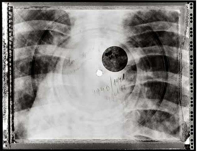 bootleg x-rays soviet 3