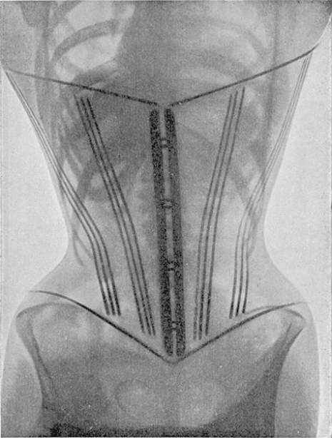 corset 1 - Flashbak