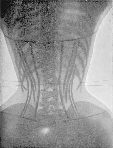 1908 corset