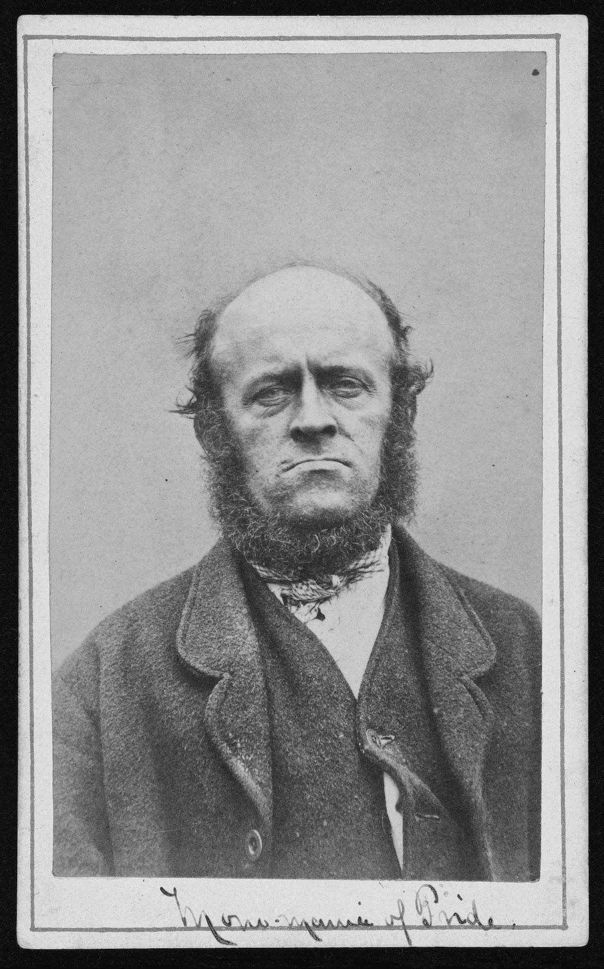 Portraits from a "lunatic asylum" Inmates at West Riding Asylum, in Yorkshire, England