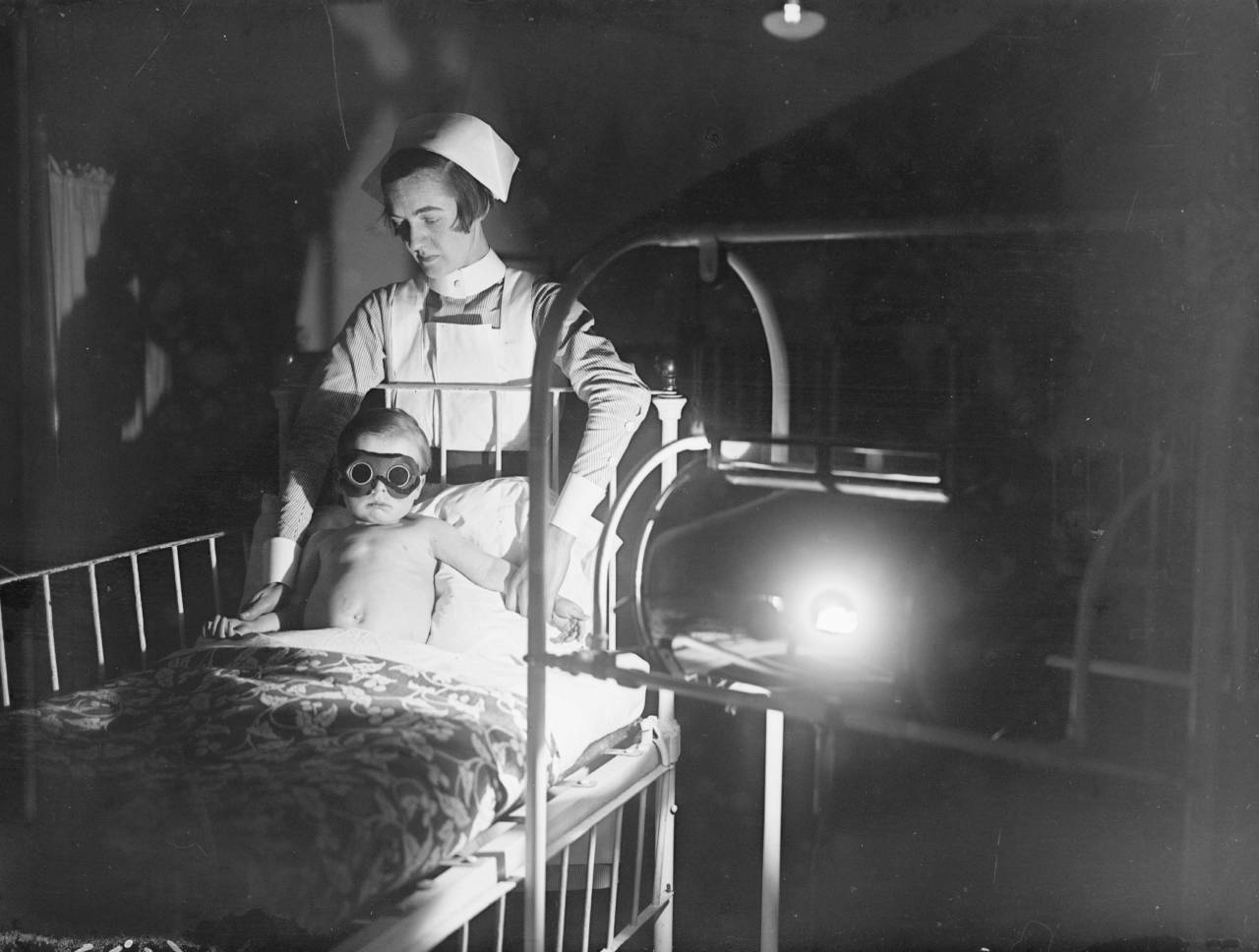 February 1928: A child wearing goggles and held by a nurse, undergoes sun-ray treatment at Cheyne Hospital for Children, Chelsea. (Photo by Fox Photos/Getty Images)