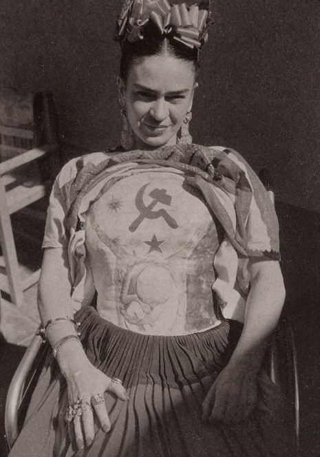Pregnant Frida in plaster corset 1951