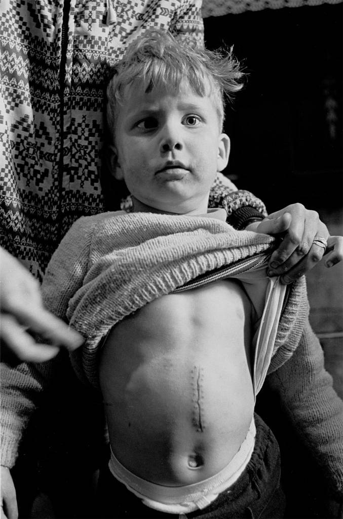 The result of dangerous play, the little boy fell on a rusty nail which punctured his liver, Newcastle 1971