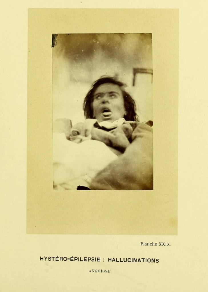 Hystero- Epilepsy - Hallucinations Anxiety mental health patient paris 1800s Paris Chalcot