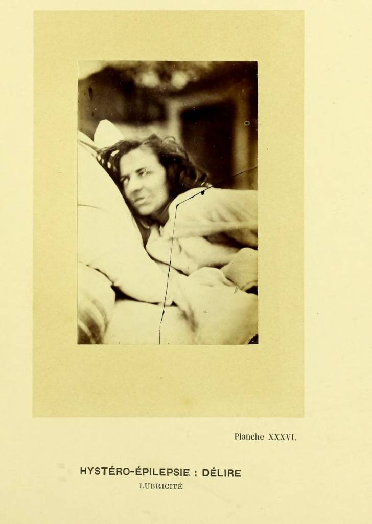 Hystero- Epilepsy. mental health patient paris 1800s Paris Chalcot