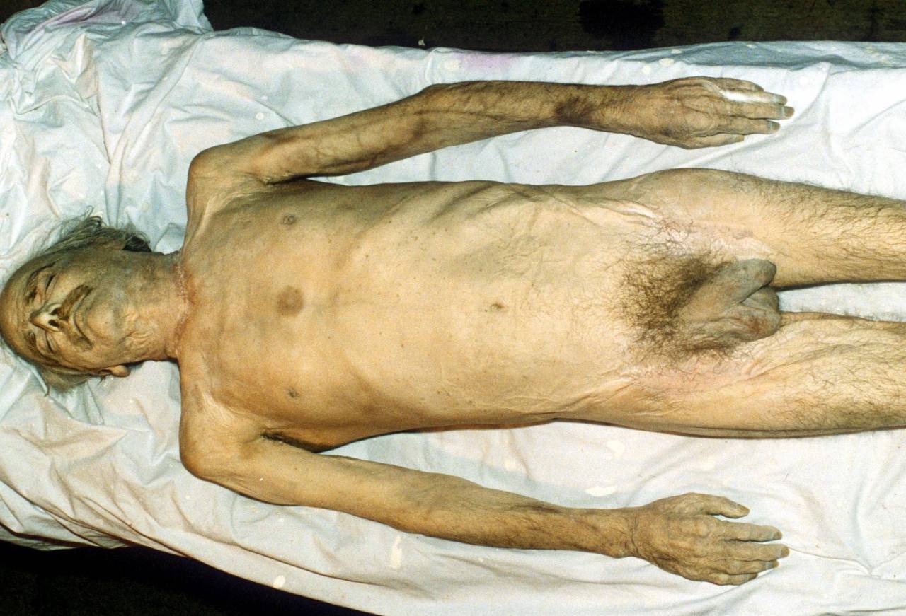 DEAD BODY OF EDWIN MCKENZIE EDWIN MCKENZIE,TRAMP KNOWN AS 'DIOGENES', EMBALMED BY ARTIST ROBERT LENKIEWICZ, PLYMOUTH, DEVON, BRITAIN - 1985