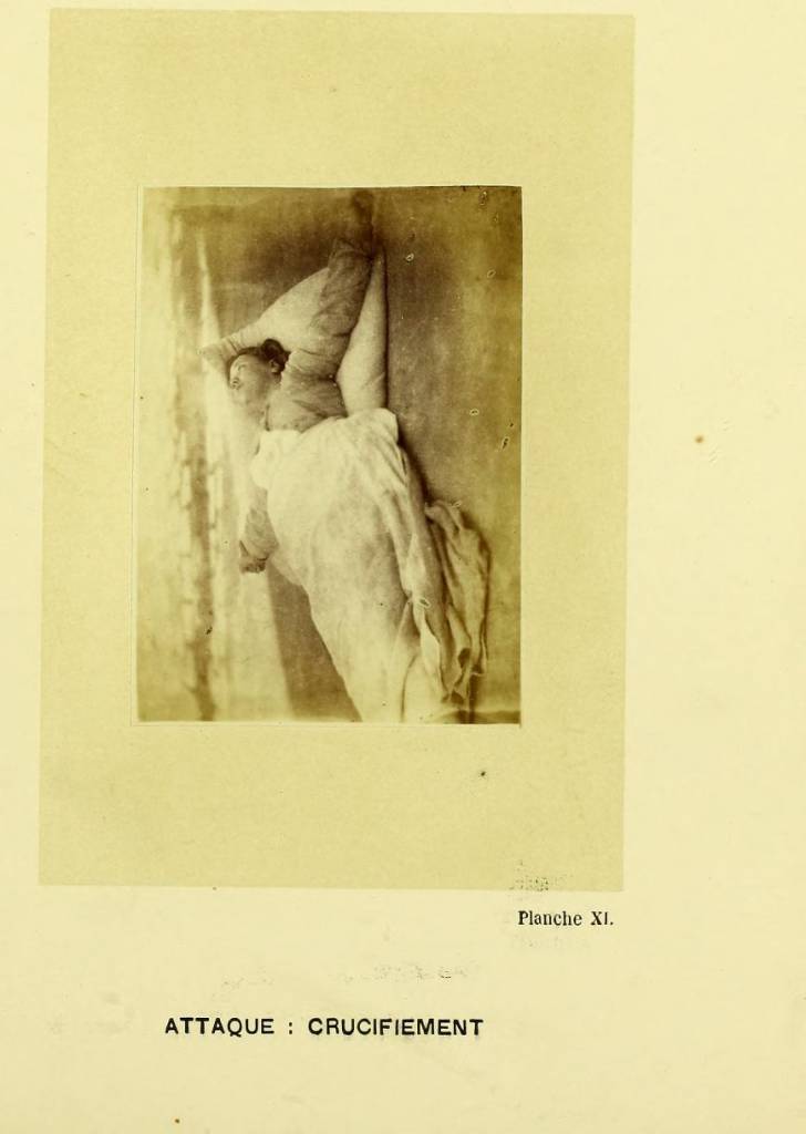 mental health paris 1800s Chalcot hysteria