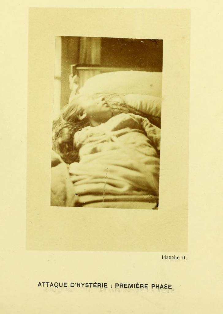 mental health paris 1800s Chalcot hysteria