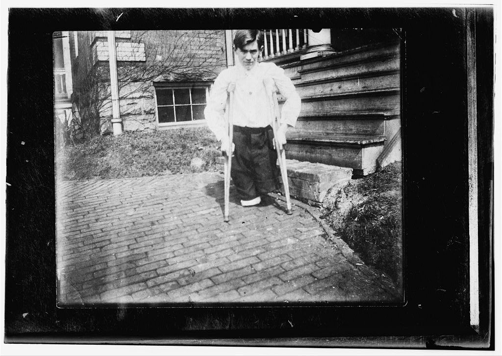 Monongah, W. Va. Nola McKinney, Secretary, 1910, West Virginia Child Labor Committee. Frank P......., whose legs were cut off by a motor car in a coal mine in West Virginia when he was 14 years 10 months of age. Location: Monongah, West Virginia.