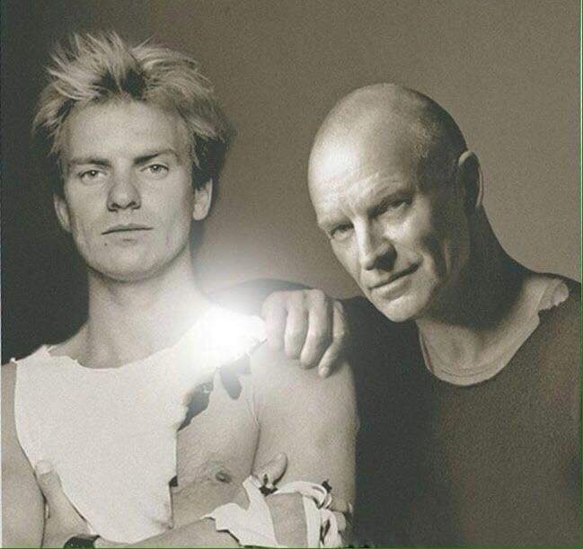 pop stars then and now Sting