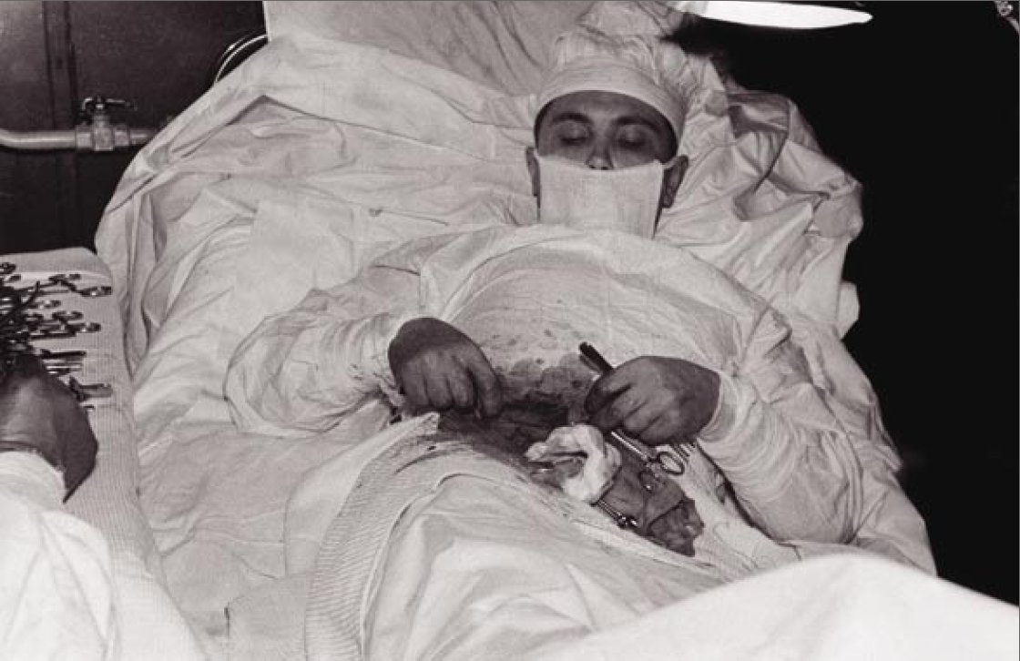 Leonid Rogozov appendix
