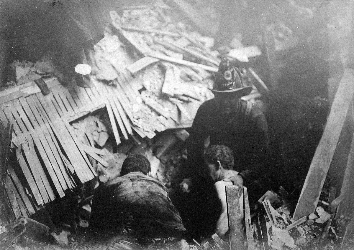 Photograph of a San Francisco Fire & Earthquake Burn Victim  Year 1906   8x10 