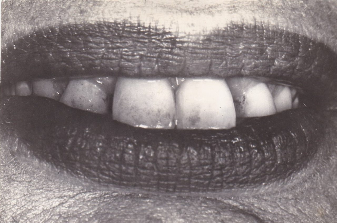 teeth