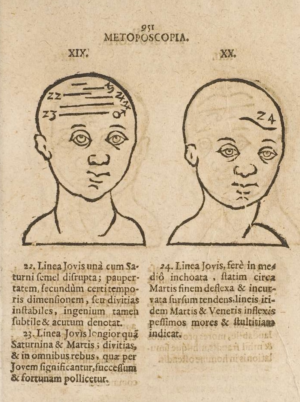 Metoposcopia