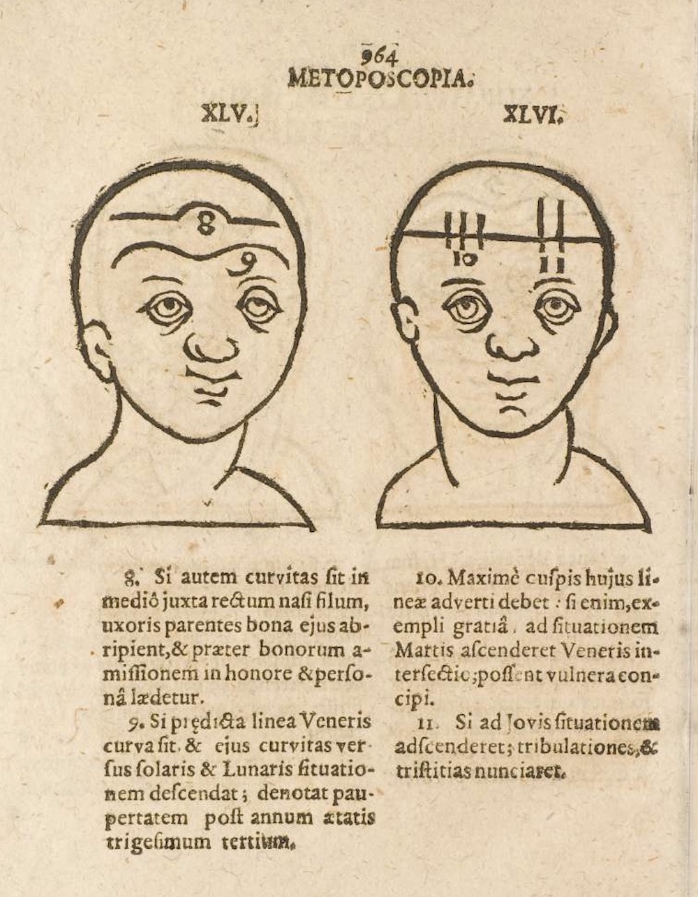 Metoposcopia