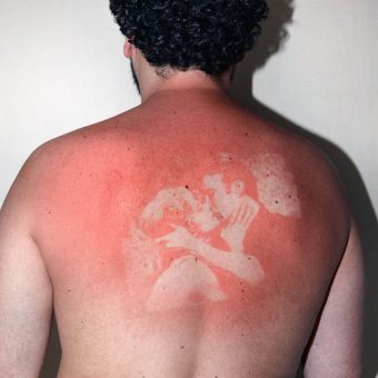 Illustrated People: Artist Burns Old Photos Onto Human Skin